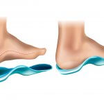 מעלימים את הכאב – מדרסים בהתאמה אישית ב- 99 ש״ח בלבד לכל חברי קופות החולים!