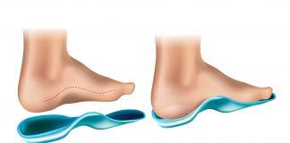 מעלימים את הכאב – מדרסים בהתאמה אישית ב- 99 ש״ח בלבד לכל חברי קופות החולים!