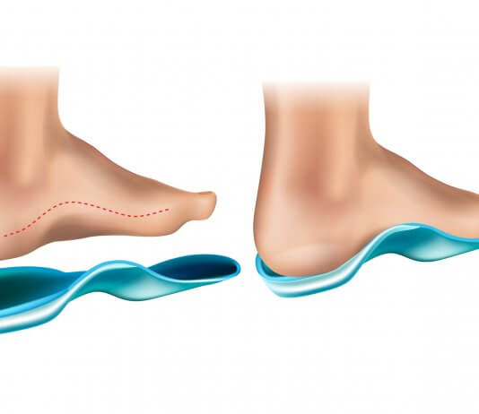 מעלימים את הכאב – מדרסים בהתאמה אישית ב- 99 ש״ח בלבד לכל חברי קופות החולים!